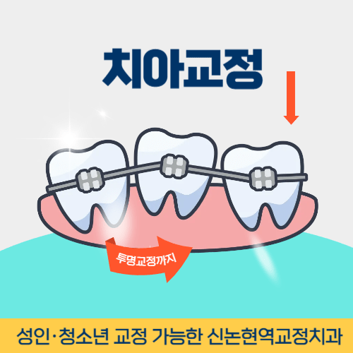 제천치과 제천시 치과 치아교정