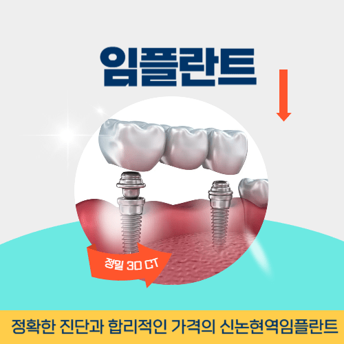 제천치과 제천시 치과 임플란트