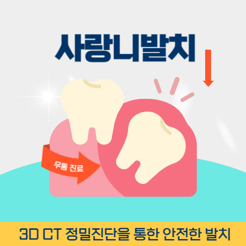 제천치과 제천시 치과 사랑니 발치